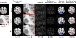 Study: Medical Image AIs Need a Good “Hallucination Map”