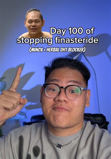 Natural DHT Blockers: Moving Beyond Finasteride