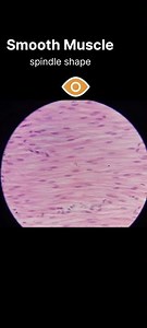 How to identify Smooth muscle Histology slide #learnanatomywithfun #anatomy