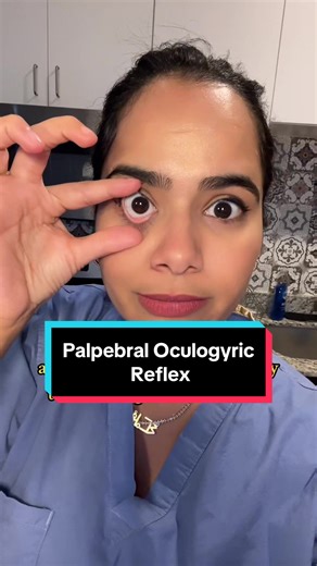 The palpebral oculogyric reflex, also known as Bell's reflex, is the upward and outward movement of the eyes when the eyelids close against resistance, it is t’also one of the signs we see in patients with #bellspalsy 👀 #ophthalmology #cornea #eyesurgeon #stemtok #medtok