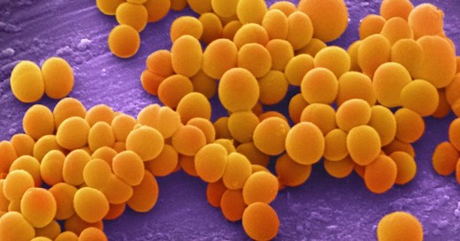 What is antibiotic resistance? | Science Museum