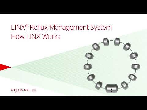 How LINX Works