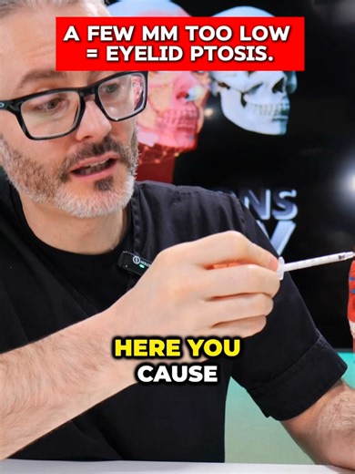 Around the brow, millimetres matter. Too high → brow ptosis Slightly lower → brow lift Too low → eyelid ptosis Understanding complications is part of being a safe injector. Inside Complications Mastery, I teach you how to prevent, diagnose and manage toxin & filler complications with confidence. 💉 Save £288 for a VERY limited time, more info via my profile.
