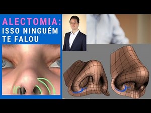 Alectomy: what no one tells you