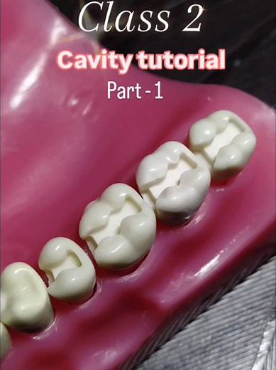 Class 2 Cavity Tutorial: Key Techniques for Dental Students
