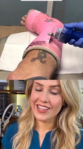 29K views · 85 reactions | Doctor reacts: cast removal gone wrong | Footdocdana | Facebook