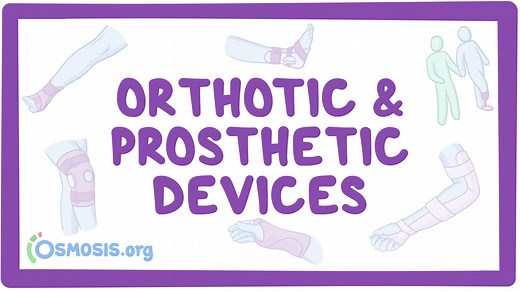 Orthotic and prosthetic devices: Video, Causes, & Meaning | Osmosis
