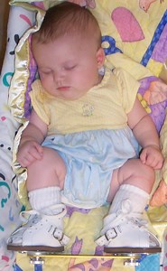 Shin Splints - Why They Happen and How to Stop Them