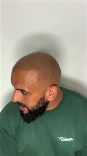 The goat of football trusts him with his safety, he trusts us with his hairline