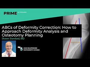 Deformity Correction: How to Approach Deformity Analysis & Osteotomy Planning - Shawn Standard, MD