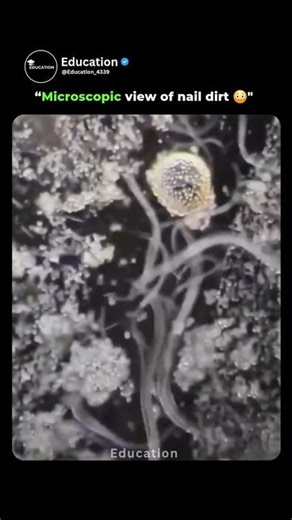 Microscopic View of Nail Dirt 🔬😳 | #Microscope #Nails #Hygiene #ScienceFacts #Knowledge #shorts