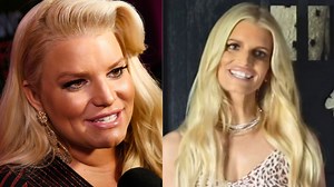 514K views · 1.9K reactions | Celebrities That Destroyed Their Faces With Botched Plastic Surgery #plasticsurgery #botched | Inform Overload | Facebook