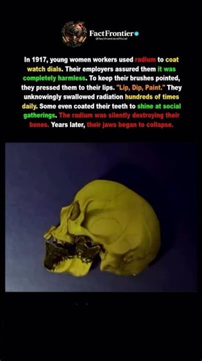 They Were Told Radium Was Safe. It Slowly Ate Their Bones. #darkhistory #history