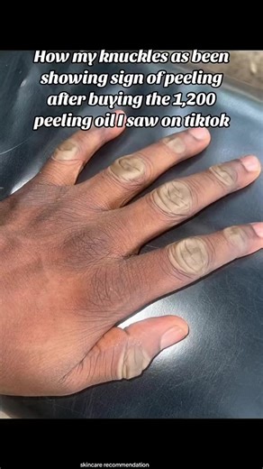 #glowbykay #viraltiktok #skincaretips #viral #foryou skincare recommendation skincare reviews Skincare recommendation for oily skin skincare recommended for dry skin skincare restock and organizing skincare recommendation for acne skincare remedies skincare restock skincare recommendations for combination coffee scrub for body coffee scrub for face coffee scrub coffee scrub whitening coffee scrub for stretch marks coffee scrub exfoliate coffee scrub soap coffee scrub for under eve coffee scrub f