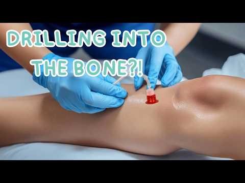 Why Nurses Drill Into Bone in Emergencies (IO Access Explained)
