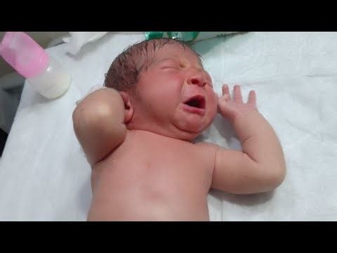 Newborn Baby Initial Assessment | Check RBS & Temperature | NICU Baby Care