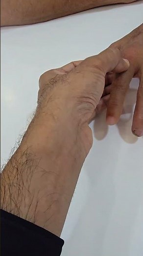 Artificial Finger That Looks Real | Silicone Cosmetic Prosthesis