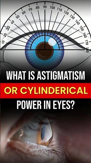 What is Astigmatism or Cylindrical Power in Glasses? 👁️👓