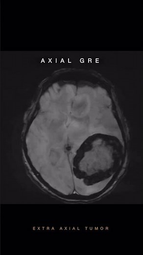 Brain MRI Sequences Simplified | Radiology #Shorts