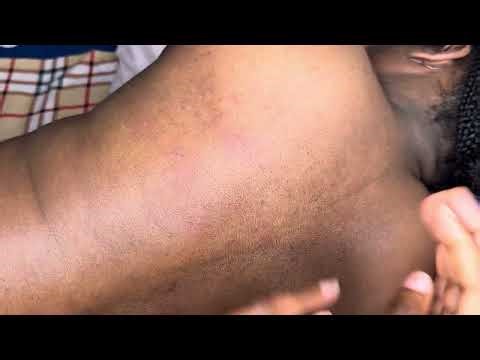 Satisfying Back Nitpicking Sounds & Attention