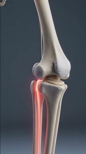 무릎 통증 부위별 원인 완벽 정리! 이 증상이면 의심하세요 #무릎통증 #쇼츠