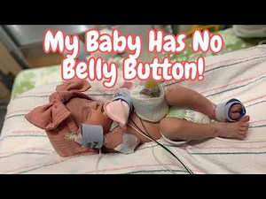 My Baby Has No Belly Button! 😲 | CATERS CLIPS