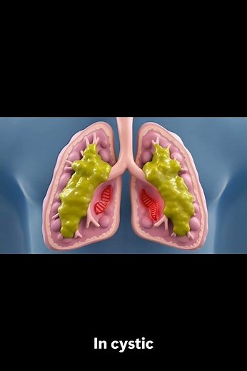 Gene Therapy Explained