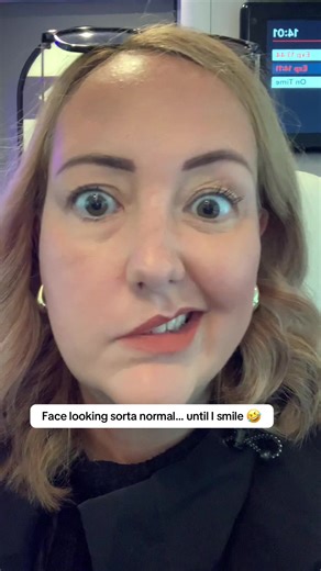 Living with Facial Palsy: A Comedian's Journey