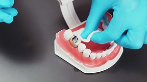423K views · 547 reactions | What Actually Happens During a Dental Visit | Transformazing | Facebook