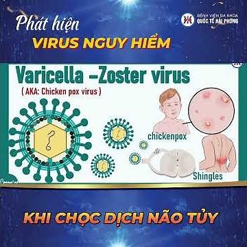 PHÁT HIỆN VIRUS N.G.U.Y H.I.Ể.M KHI CHỌC DỊCH NÃO TỦY