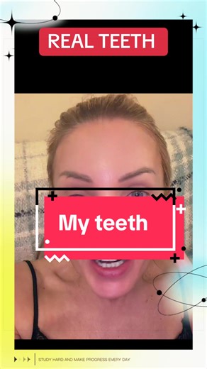 Transform Your Smile: Teeth Whitening for Over 40s