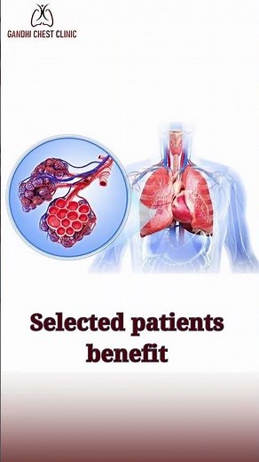 What Happens If COPD Keeps Progressing? | Early Signs to Advanced Stages Explained