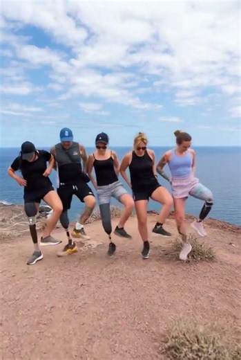Dancing Beyond Limits 💃🕺 Inspiring Strength with Prosthetic Legs Amputation