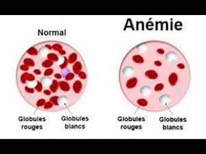 10 aliments pour combattre l'anémie