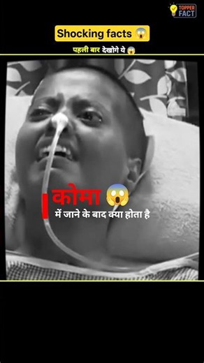 कोमा में इंसान के शरीर के साथ क्या होता है? 😨 #facts #coma #factsinhindi