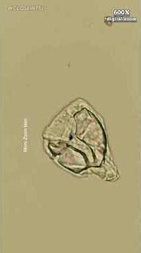 Tap Water Under a Microscope #microbiology #microscope #stem #tapwater #science