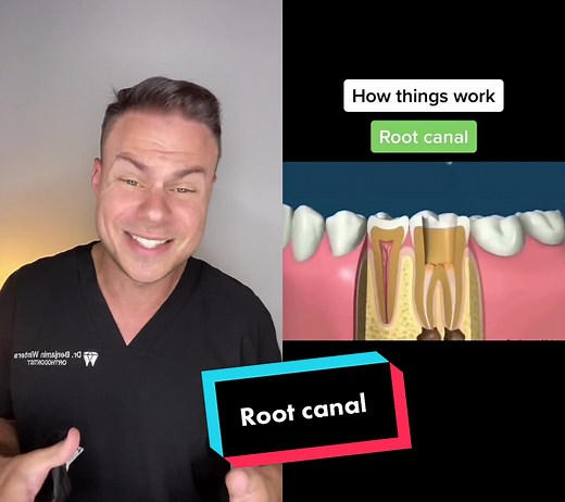 Understanding Root Canals: Procedures and Benefits