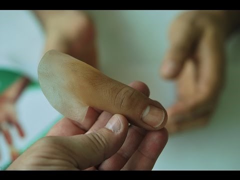 Protesis para dedo pulgar, (prosthetic thumb) No. 101