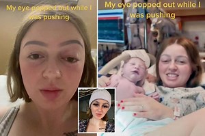 Woman pushed so hard while giving birth that her eye ‘popped out’