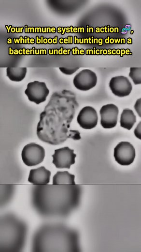 Captured under a high-powered microscope, this remarkable footage reveals a dramatic moment from within the human body: a white blood cell actively tracking, pursuing, and ultimately attacking a bacterium. This is not animation or CGI, but a real immune response unfolding at the microscopic level. White blood cells constantly patrol our bloodstream and tissues, identifying harmful invaders by subtle chemical signals before moving in with precision and purpose. What looks like a slow chase here i