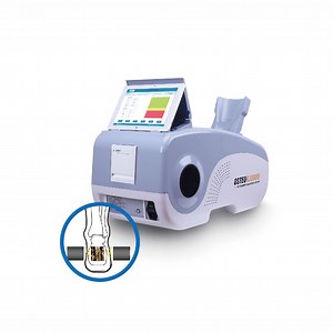 [Hot Item] Bone Density Check Ultrasound Bone Densitometer for Checking Osteoporosis