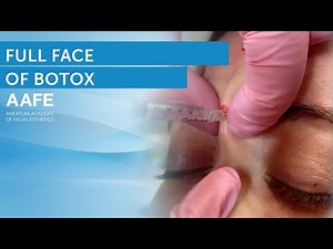 Full Face of Botox Procedure