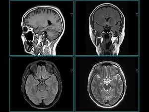 MRI brain imaging – miraculous images of the human brain helping to diagnose disease.