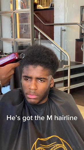 Fixing a Difficult Hairline Transformation