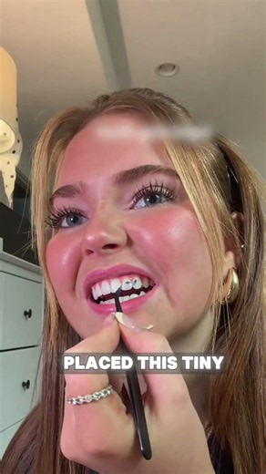 tooth gem tutorial for dummies