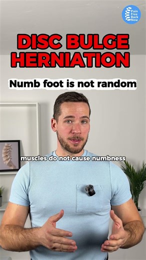 Why Your Foot Goes Numb With Sciatica