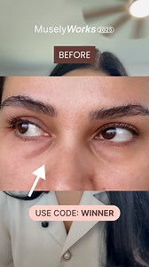 30% OFF all Musely treatments 🎉 Celebrate the inspiring stories and transformations of our MuselyWorks winners! Join over 1 million patients who’ve experienced life-changing results with prescription treatments for dark spots, anti-aging, hair loss, menopause, and more. 📲 Get started 100% online at Musely.com PROMOTION TERMS: Code WINNER must be input at checkout to apply 30% off any Musely treatment(s); Must be initial order with “Refill Every 2 Months” or “Refill Every 3 Months” selected at 