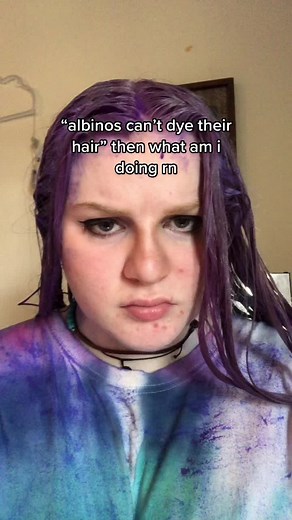 Can Albinos Dye Their Hair? Myths Debunked!