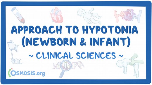 Approach to hypotonia (newborn and infant): Video & Meaning | Osmosis