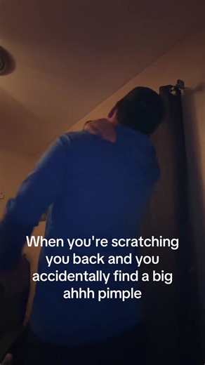 Very painful #yp #foryoupage #funny #fypシ #fypシ゚viral | Back Scratching